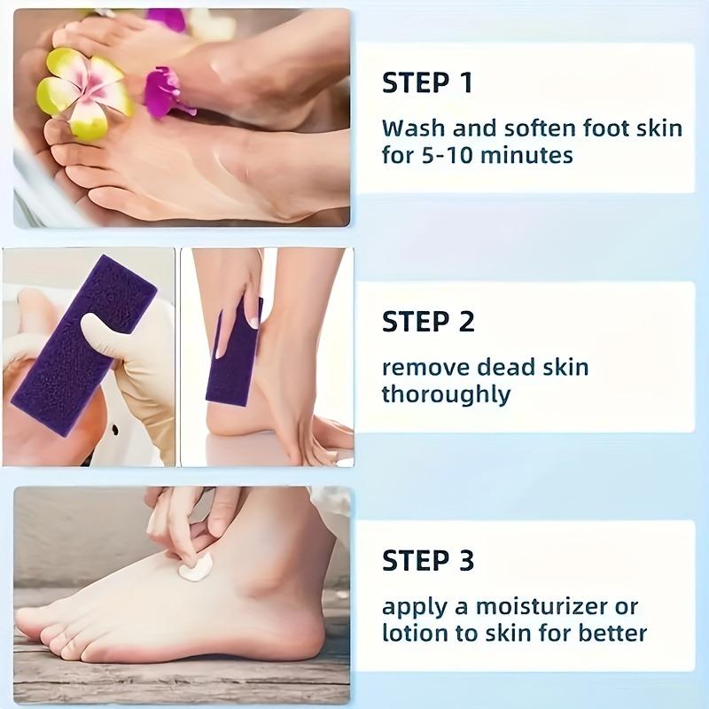 SoftStep™: Finally Say Goodbye to Rough, Cracked Heels